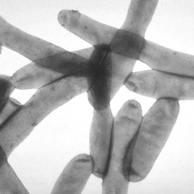 bactérie legionella pneumophila pneumonie Argentine