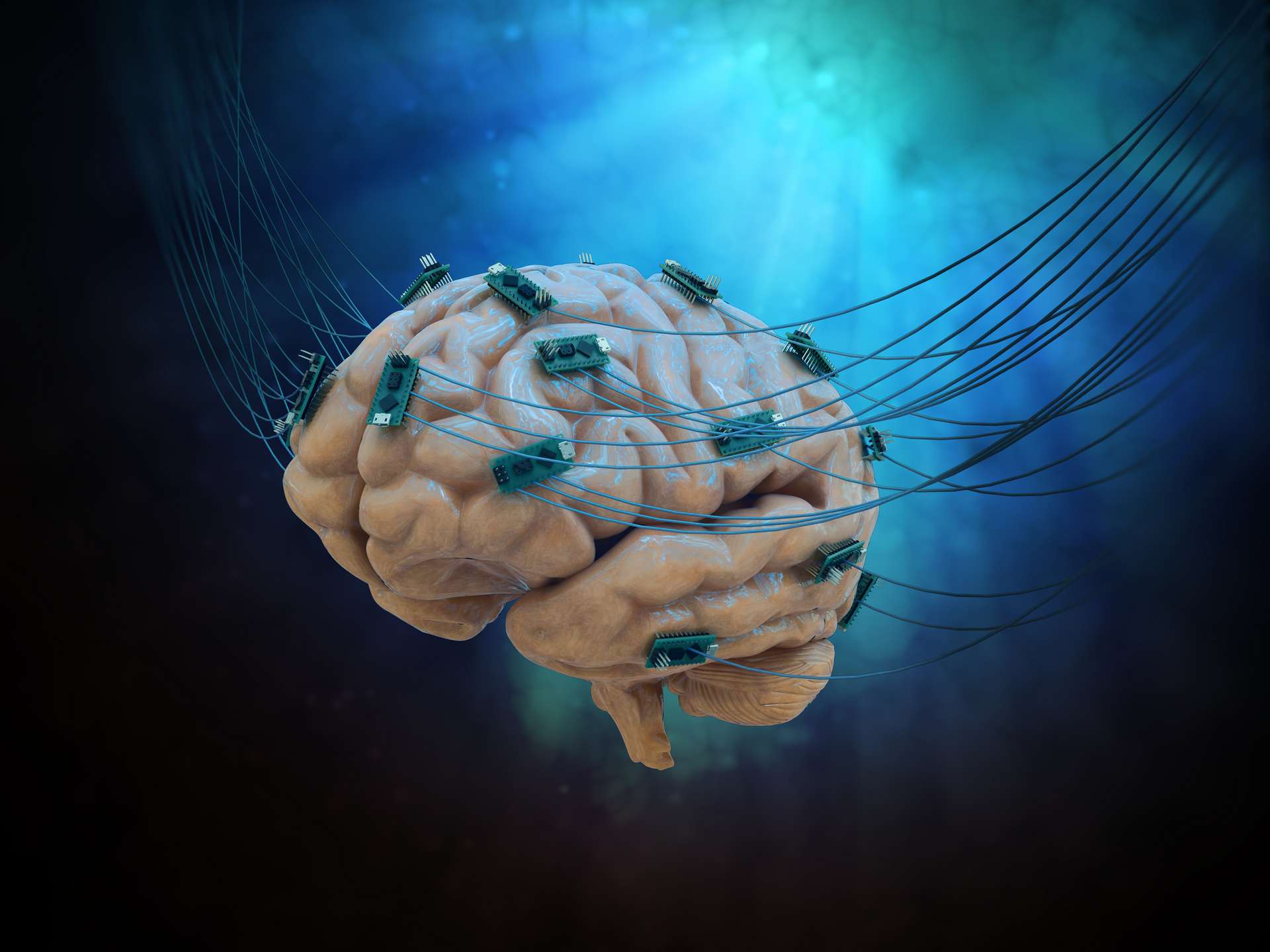 prothese cerebrale restaurer memoire cerveau endommage couv