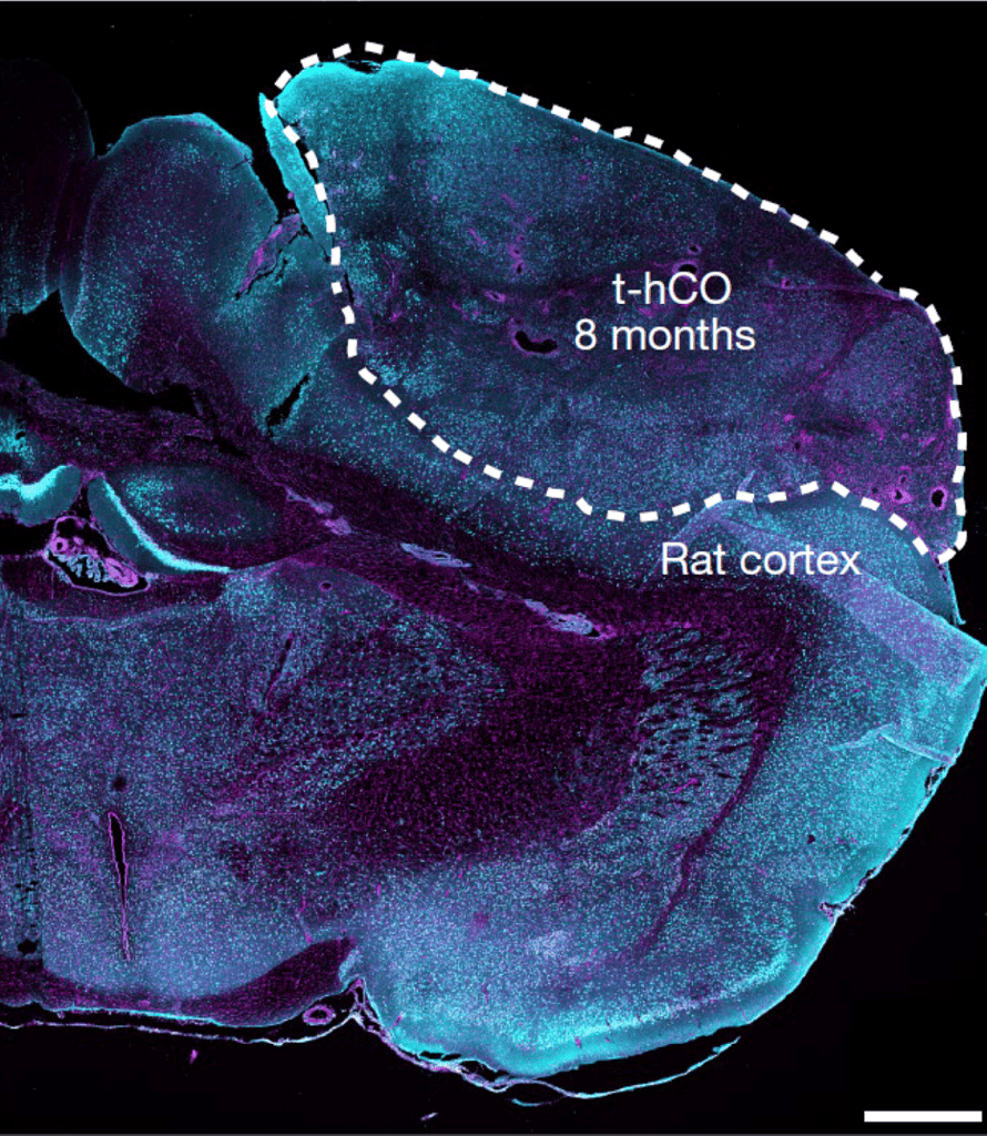 cerveau rat cortex humain greffe