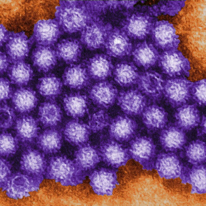 norovirus declencheur maladie crohn nouvelle therapie couv