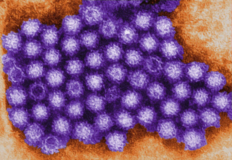 norovirus declencheur maladie crohn nouvelle therapie couv