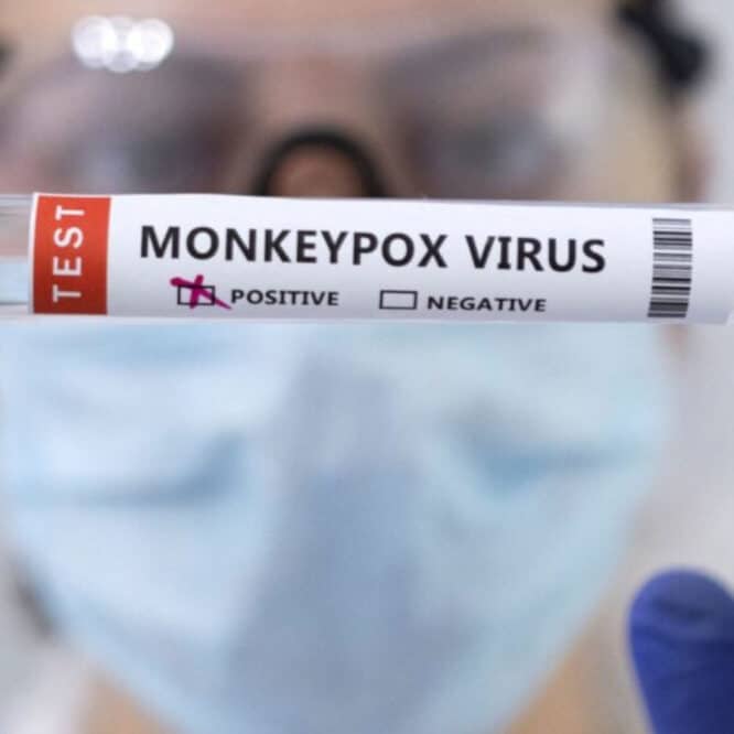 virus variole du singe République Démocratique du Congo