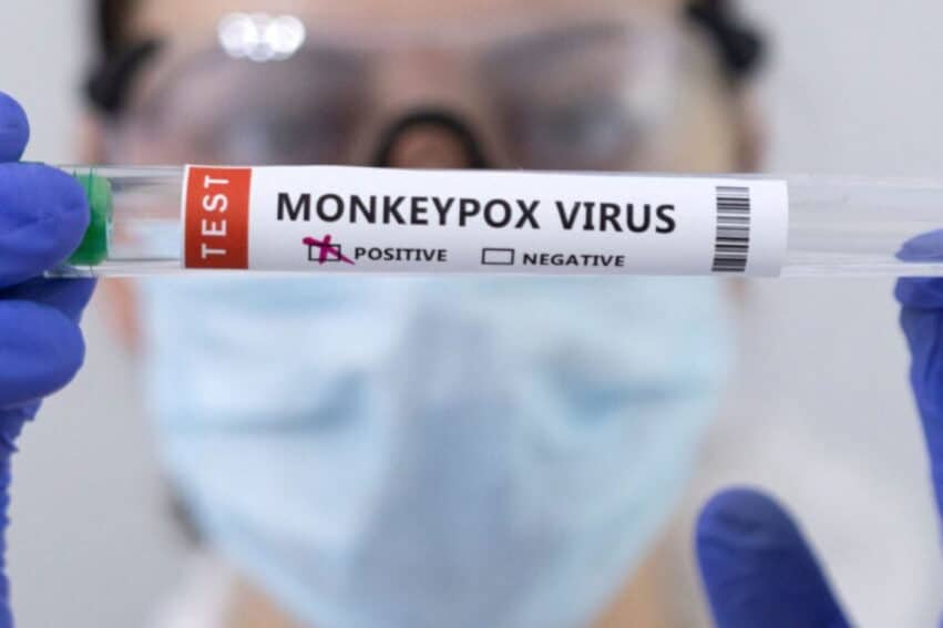 virus variole du singe République Démocratique du Congo