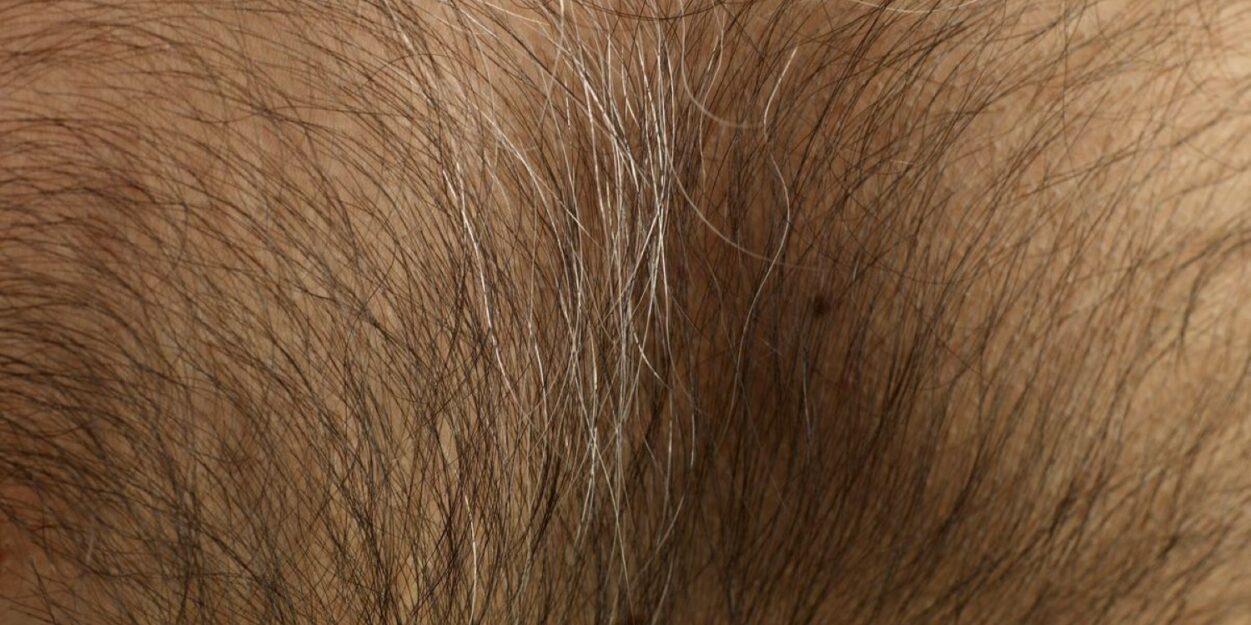 perte manteau fourrure homme evolution gene couv