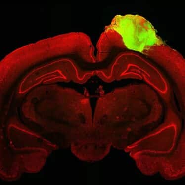 reparation cerebrale rats organoides humains