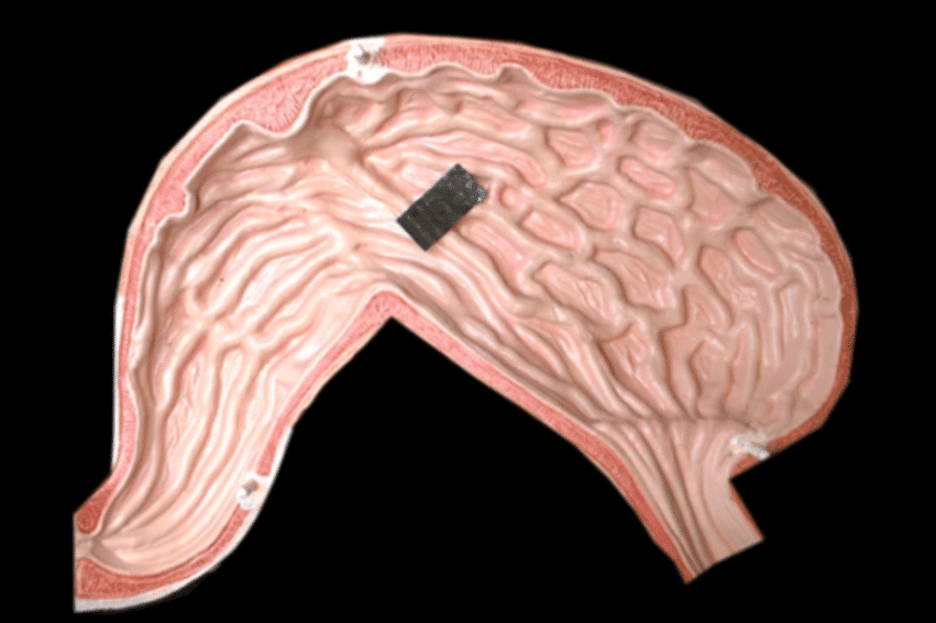 mini robot pangolin effectue soins medicaux internes couv