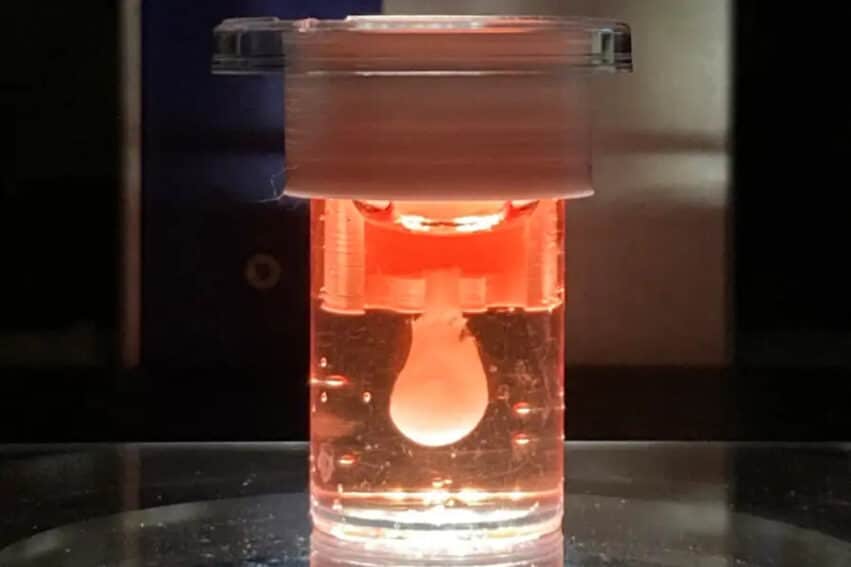 ventricule cardiaque battre 3 mois