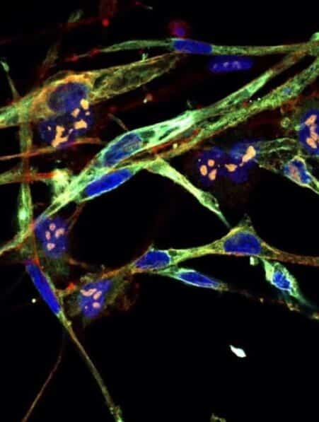 cellules musculaires cancer transformer cellules saines couv