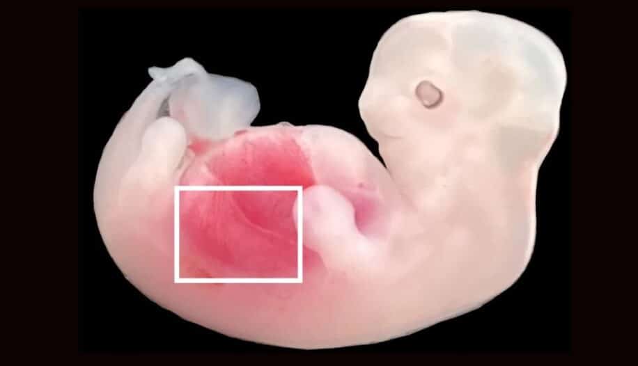 rein humain cultiver dans embryon porc couv