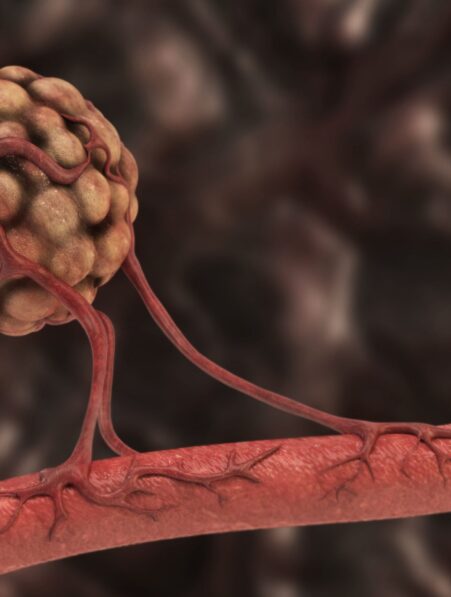 role antioxydants developpement vaisseaux sanguins cancer