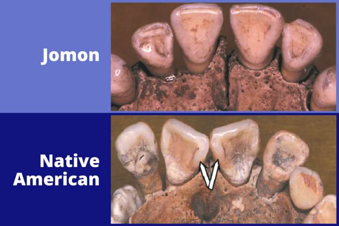 comparaison dent