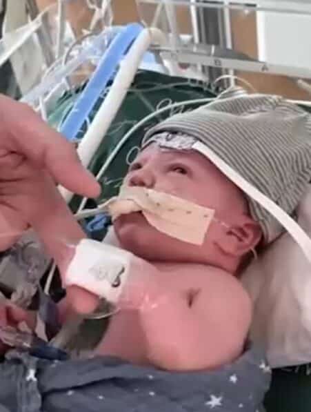 greffe cardiaque partielle bebe succes un an apres couv