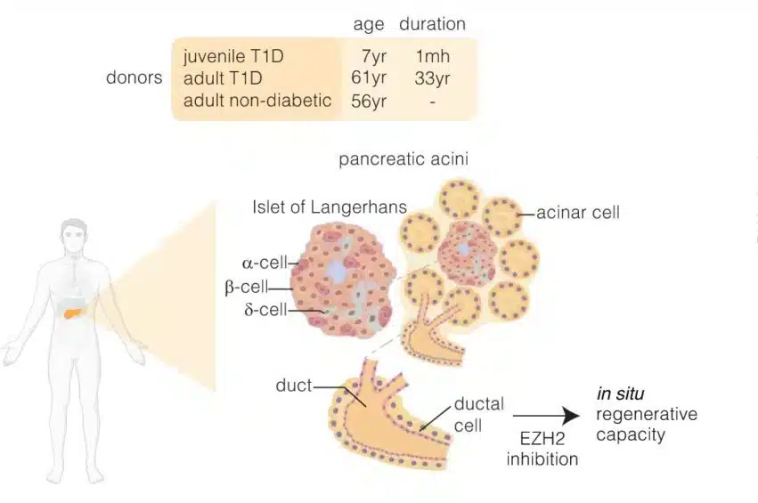 medicaments dt1