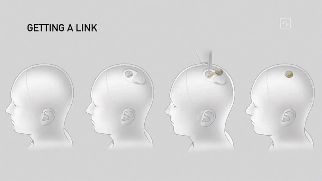 neuralink bci
