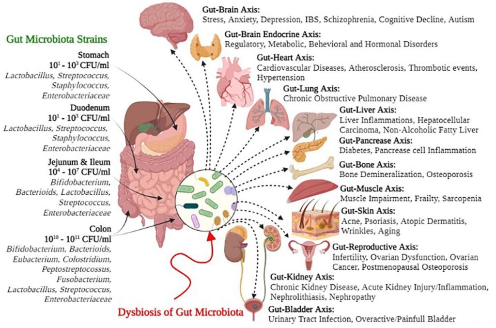 dysbiose intestinal