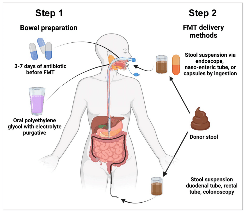procedure fmt