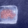 tissus cerebraux fonctionne cryogenisation