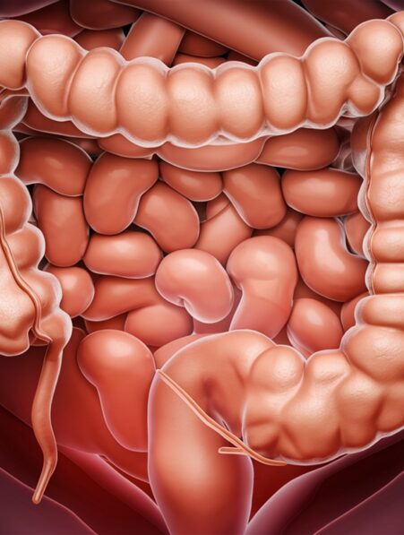 Des scientifiques découvrent la cause majeure de la maladie inflammatoire de l intestin couv