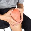 Arthrose une seule injection de cellules souches réduit la douleur de 58 % et répare le cartilage du genou