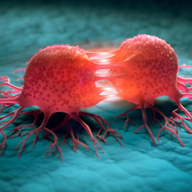 gene agressivite cancer pancreas