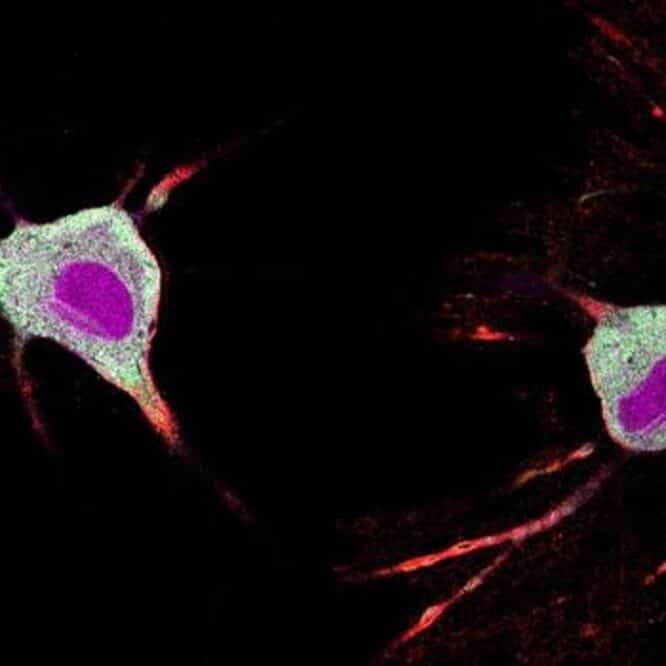 Un outil basé sur des protéines permet d’observer l’effet des psychédéliques sur les neurones selon une étude