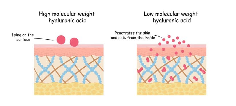 acide hyaluronique