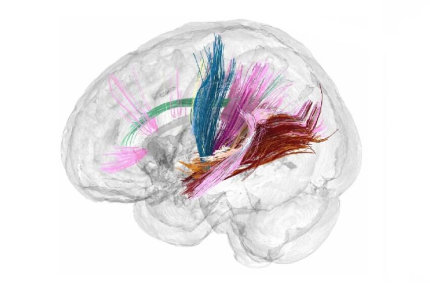 Une étude révèle les effets de la grossesse sur le cerveau d une femme