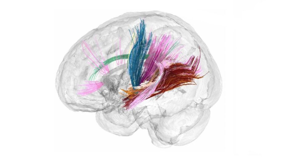 Une étude révèle les effets de la grossesse sur le cerveau d une femme