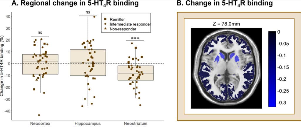 depression cognitif