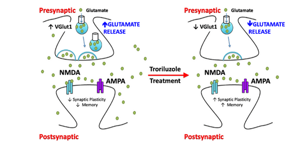 glutamate alzheimer