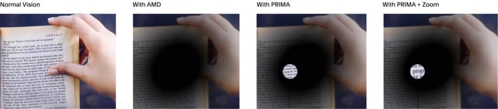 prima