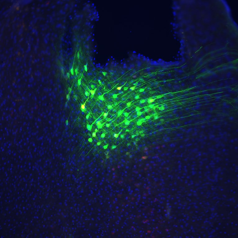 neurones dacc souris controle respiration anxieuse