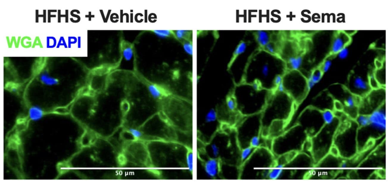 semaglutide effet cardiomyocytes