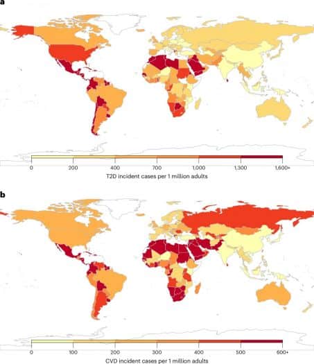 Incidence diabète de type 2 et des maladies cardiovasculaires chez les adultes dans 184 pays en 2020