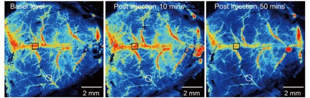 microplastique cerveau