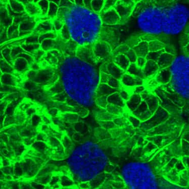 parasite cellules restes deguisement