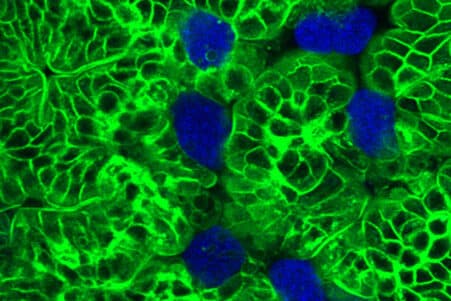 parasite cellules restes deguisement