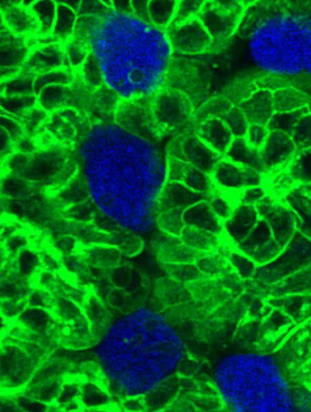parasite cellules restes deguisement