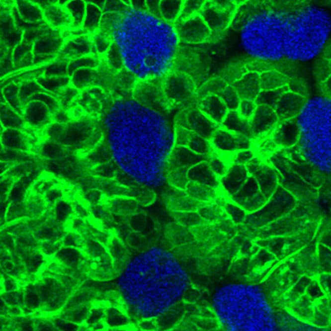 parasite cellules restes deguisement