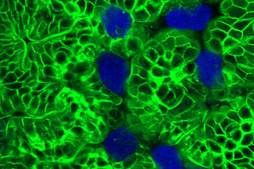 parasite cellules restes deguisement