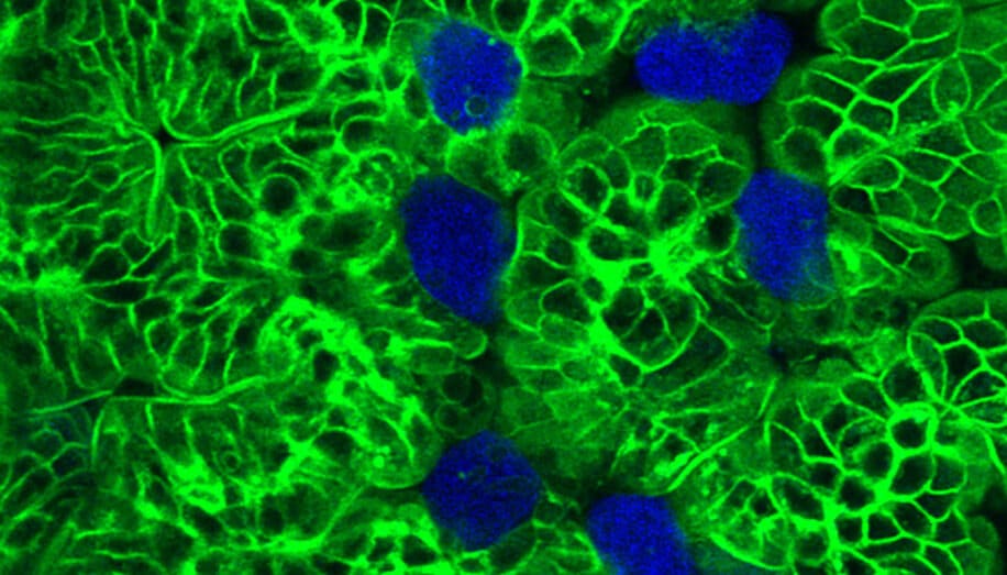 parasite cellules restes deguisement