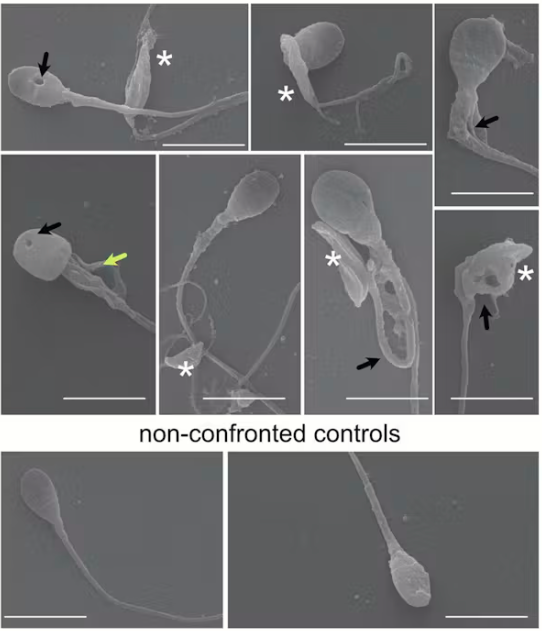 spermatozoides toxoplasmose spermatozoides toxoplasmose