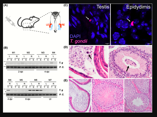 toxoplasmose testicules toxoplasmose testicules