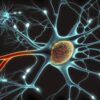 alzheimer somnifere neurodegenerescence