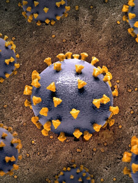 mpox variole singe sierra leone