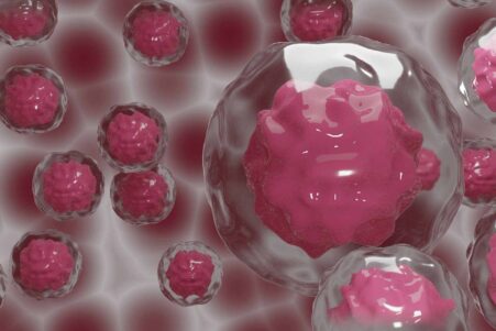 maladies auto-immunes therapie cellulaire
