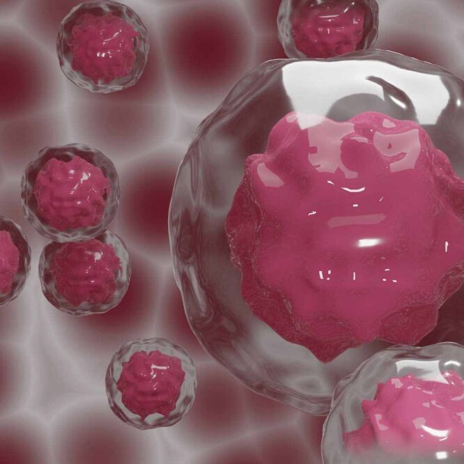 maladies auto-immunes therapie cellulaire