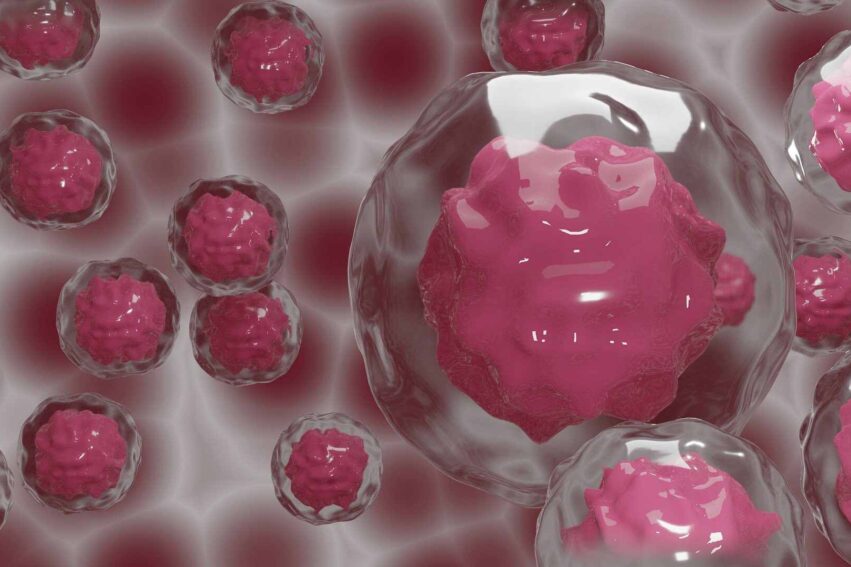 maladies auto-immunes therapie cellulaire
