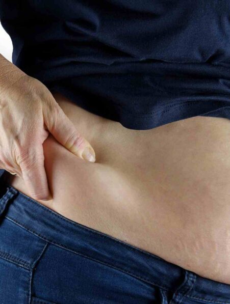 medicaments obesite reprise poids