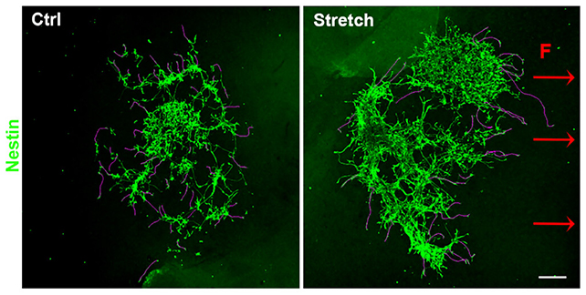 nanoparticules parkinson